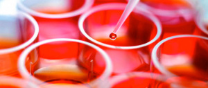 Stamina, la morte della piccola Rita rischia di rinfocolare i conflitti