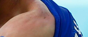 Il morso di Suarez a Chiellini finisce in Procura. E il Codacons nel ridicolo