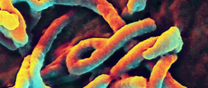 L’Onu: «L’ebola è una minaccia mondiale, stiamo perdendo la battaglia contro il virus»
