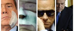 Stampelle, cerotti, tutori, occhiali: tutti i malanni di Berlusconi (GALLERY)
