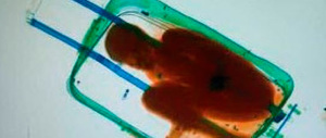 Riaffidato alla madre il bimbo che viaggiava nascosto in un trolley