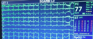 Sgarbi posta su Fb la foto dell’elettrocardiogramma. “Tutto bene”