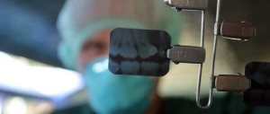 Alla sbarra il “dentista degli orrori”. Strappava denti sani senza anestesia
