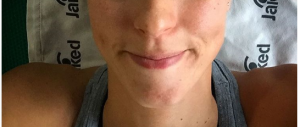 Federica Pellegrini portabandiera a Rio: “Ma quanto dolore…” (foto)