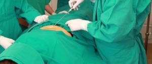 Morta a 39 anni dopo la liposuzione: a processo chirurgo estetico romano