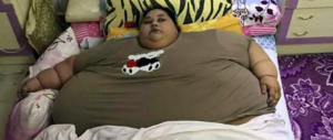 Donna egiziana di 36 anni pesa 500 kg: adesso sarà operata in India (video)