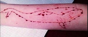 Brindisi: ragazza con ferite al braccio, si teme la sfida suicida della “Balena blu”