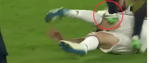 Intervento killer su Higuain: la gamba si piega ma non si spezza (video)