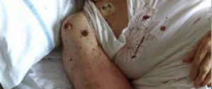 Ricoverata in un letto pieno di formiche. La foto della vergogna