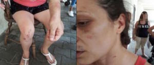 Roma, parla la mamma aggredita nel centro di accoglienza al Tiburtino III
