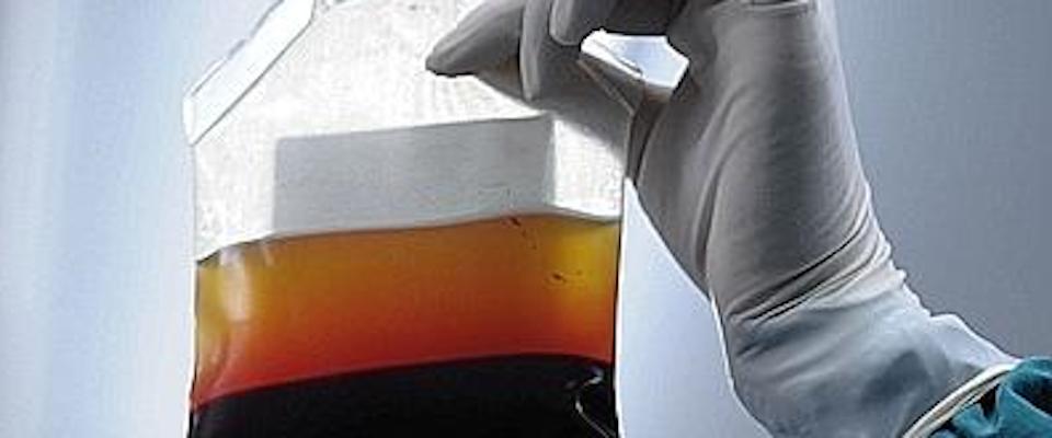 Trasfusioni di sangue infetto, il ministero deve risarcire i contagiati