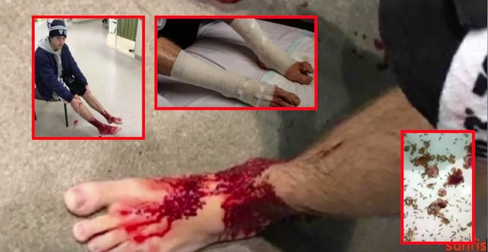 Si tuffa in mare, “creature misteriose” gli divorano a sangue le gambe (video)