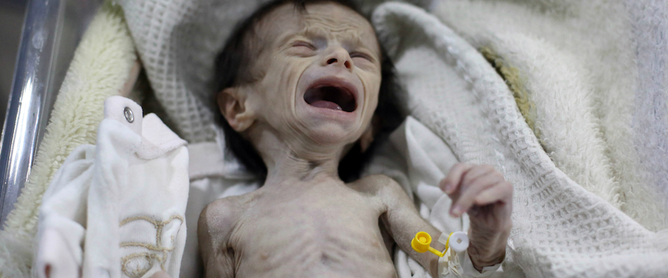 La foto terribile della bimba morta di fame in un villaggio in Siria