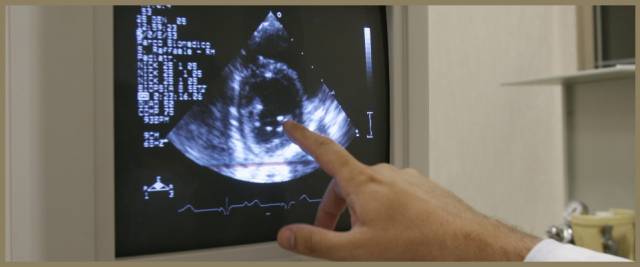 scompenso cardiaco