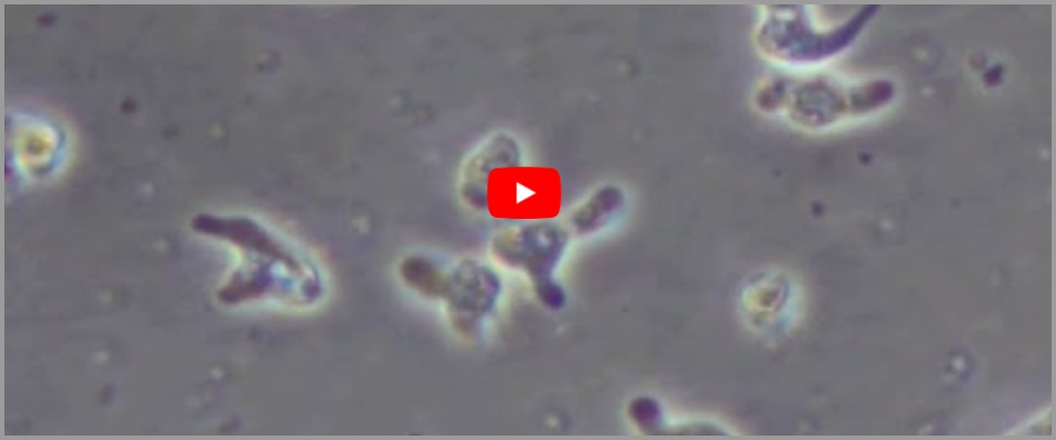 Ameba mangia cervello, il rischio cova anche nei lavaggi nasali. Gli esperti: usare solo acqua “sicura” (video)