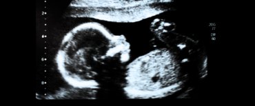 aborto fino alla nascita