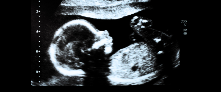 aborto fino alla nascita aborto fino alla nascita