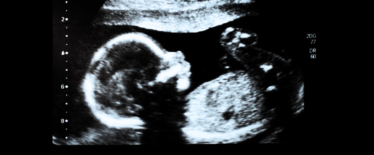 il regno unito depenalizza l8217aborto fino alla nascita l8217ultima follia del progressismo d8217oltremanica