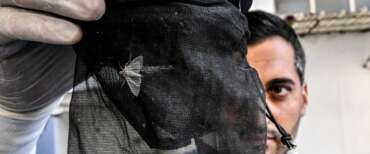 West Nile, seconda vittima nel Lazio: 77enne morto allo Spallanzani. Aveva patologie croniche ed era reduce da un trapianto