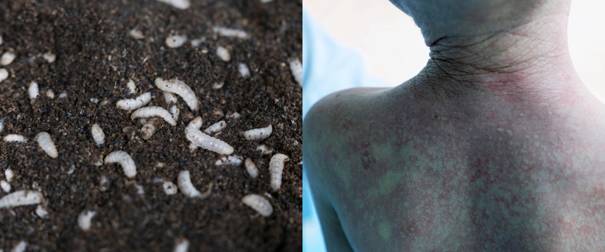 Larva mangia carne: allarme dagli Usa, c’è un paziente zero. Finora il parassita non aveva mai attaccato l’uomo