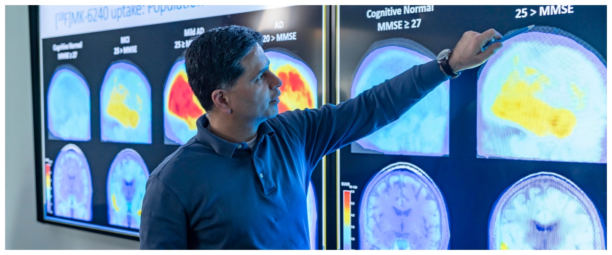 Alzheimer, la straordinaria scoperta da Harvard: la carenza di litio possibile causa della malattia Alzheimer, la straordinaria scoperta da Harvard: la carenza di litio possibile causa della malattia