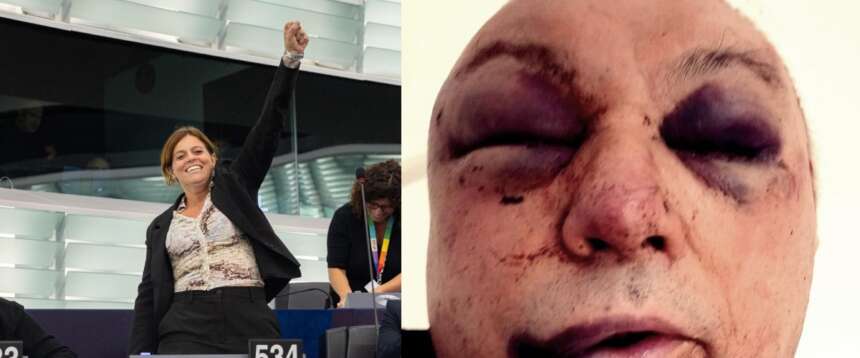 Salis impunita, la rabbia di una vittima sfigurata della banda del martello: andrò davanti all’Europarlamento Salis impunita, la rabbia di una vittima sfigurata della banda del martello: andrò davanti all’Europarlamento