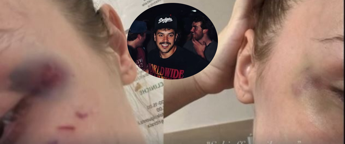 Il rapper Faneto nei guai: su Instagram la denuncia della ex e le immagini delle botte: “Morirai, non ho niente da perdere”