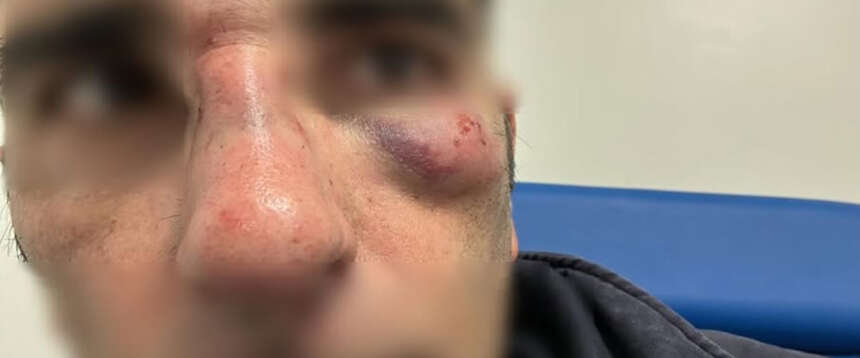 “Hai il biglietto?”. E l’immigrato prende a pugni e calci un dirigente di FdI. La foto documenta la violenza bestiale “Hai il biglietto?”. E l’immigrato prende a pugni e calci un dirigente di FdI. La foto documenta la violenza bestiale