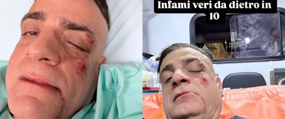 Cicalone aggredito a Roma da un branco di borseggiatori in metro: preso a pugni e calci mentre era a terra