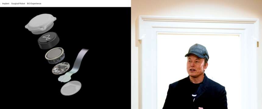 Il “miracolo” natalizio di Musk: con Neuralink restituisce l’autonomia digitale a un malato di Sla