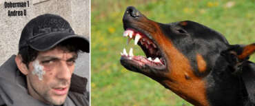 Dobermann azzanna al volto il rapper Bresh, star di Spotify: “Uno a zero per lui…”