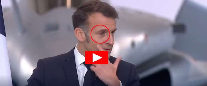 L’occhio nero di Macron: lui ci scherza su, ma i precedenti alimentano le voci maliziose… (video)