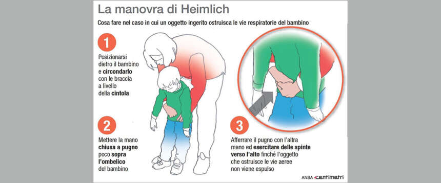 Vibo Valentia, bambina di due anni muore soffocata da un wurstel. I consigli su come intervenire