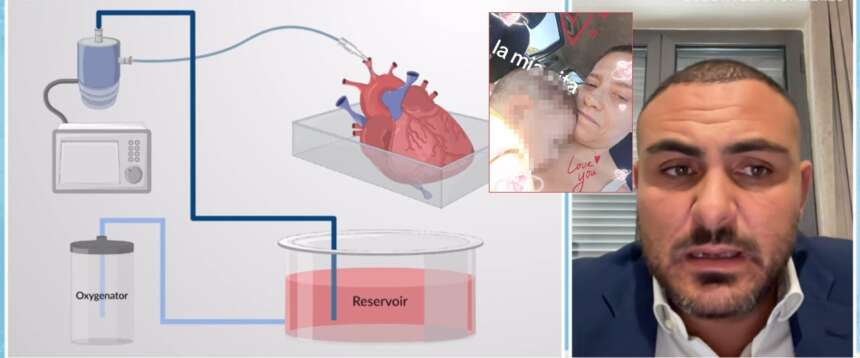 Bambino trapiantato con cuore danneggiato, le speranze appese a un filo, ma si tenta il tutto per tutto