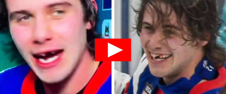 L’eroe Usa è Jack Hughes: segna il gol vittoria contro il Canada dopo aver perso due denti per una bastonata (video)