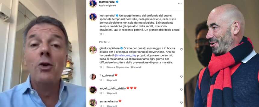 Appello social di Renzi: “Ho rimosso in tempo un melanoma, ragazzi controllatevi”. E Bassetti gli fa i complimenti (video)