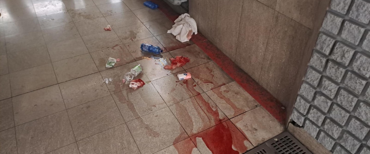 Follia a Milano, aggredisce e sfregia una 22enne in metro: «Che cosa guardi? Sono uomo e musulmano». FdI: “Espulsione immediata”
