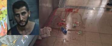 Ragazza sfregiata a Milano, il racconto agghiacciante: “Credevo di morire”. Sull’aggressore algerino indaga l’antiterrorismo