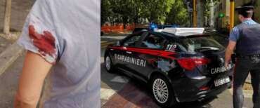 Donna colpita da un cecchino a Prati, il racconto della vittima: “Ho sentito il colpo e visto il sangue, mi devono operare”
