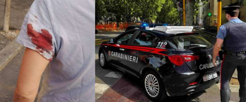 Donna colpita da un cecchino a Prati, il racconto della vittima: “Ho sentito il colpo e visto il sangue, mi devono operare”