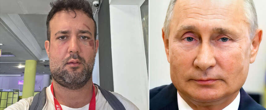 Segretario del Pd “pacifista” va in Ucraina e scopre che i droni russi fanno male: ferito alla mandibola