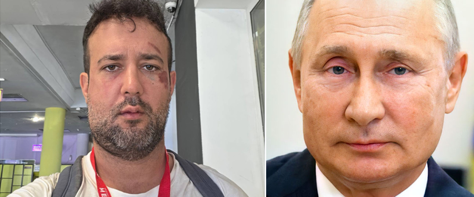 segretario del pd pacifista va in ucraina e scopre che i droni russi fanno male ferito alla mandibola da Secoloditalia.it segretario del pd pacifista va in ucraina e scopre che i droni russi fanno male ferito alla mandibola