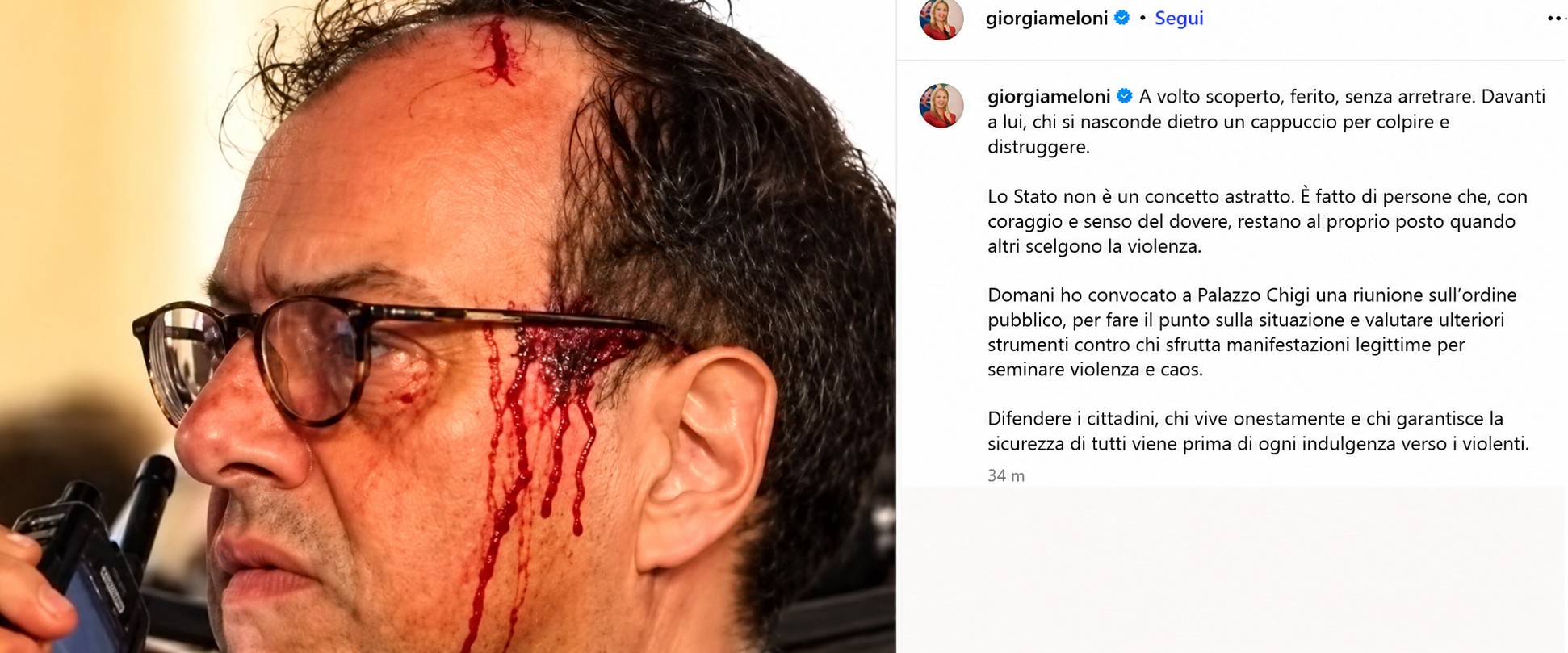 a volto scoperto senza arretrare chi 232 il poliziotto eroe esaltato dalla meloni nella battaglia contro i maranza da Secoloditalia.it a volto scoperto senza arretrare chi 232 il poliziotto eroe esaltato dalla meloni nella battaglia contro i maranza