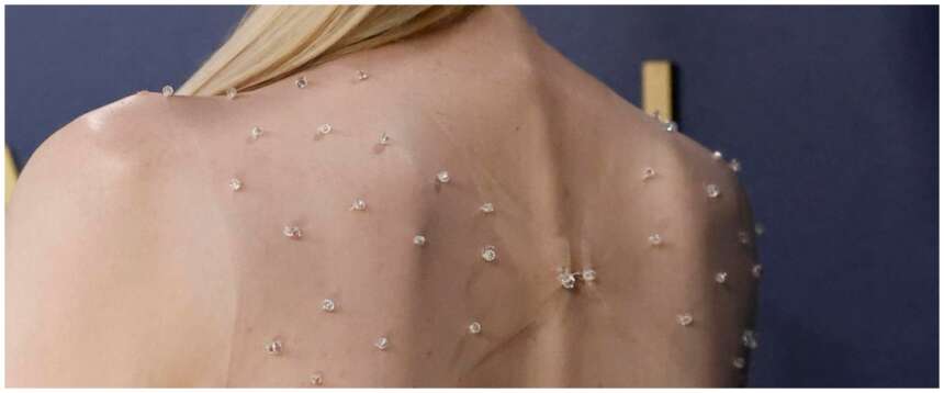 Psoriasi, la scoperta che accende la speranza: una vitamina può alleviare i sintomi. Ma 137mila italiani restano senza tutele